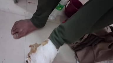 करेली: करेली पेट्रोल पंप के पास गलत दिशा से आ रही बाइक की टक्कर से पति-पत्नी घायल, अस्पताल में भर्ती