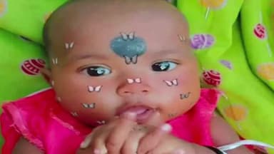 रायगढ़: मंगल कार्बन प्लांट में हादसे में घायल 9 माह की बच्ची की इलाज के दौरान हुई मौत, परिजन बोले- FIR वापस लेने बना रहे दबाव