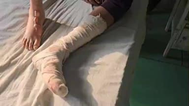 दीगोद: बूढादीत थाना इलाके के मदारिया गांव में खेत पर रखवाली कर रहे किसान आग से झुलसकर एमबीएस अस्पताल में भर्ती