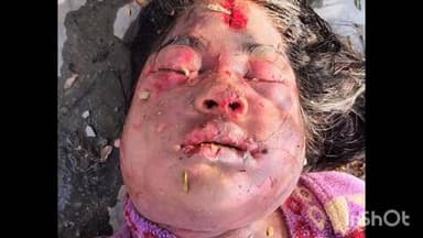 दरियापुर: सुनसान कुएं से मिली अज्ञात महिला की लाश, सिर और चेहरे पर चोट के निशान, हत्या की आशंका