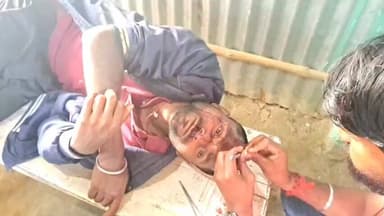 सिमरी बख्तियारपुर: सहरसा: रंगदारी न देने पर युवक का पिस्टल से सिर फोड़ा, ₹1500 छीने और जान से मारने की धमकी दी