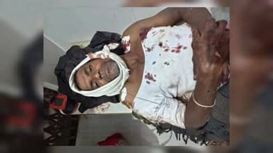 किनवट: दयाल धानोरा येथील शेत शिवारात अस्वलाने केला 9 शेतकऱ्यांवर हल्ला; एकाचा मृत्यू, चौघांची प्रकृती गंभीर