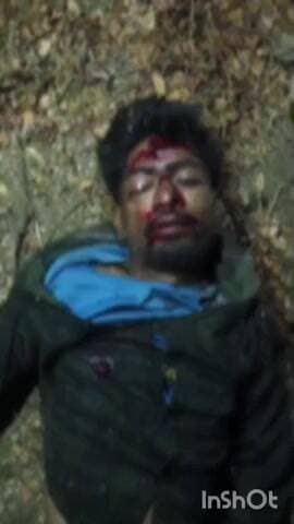 పర్వతగిరి: ఏనుగల్లు వద్ద జరిగిన రోడ్డు ప్రమాదంలో ఓ వ్యక్తికి తీవ్ర గాయాలు ఆసుపత్రికి తరలింపు