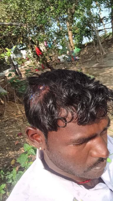 ग्राम दलपतपुर बरकोटी खुर्द मे बलराम पटेल जलाऊ नकड़ी काटने जंगल गए हुए थे बहा पर मोहन ठाकुर ने पुराने कुलाड़ी सर मे मार दी