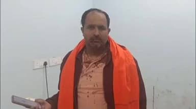 कटेया: डुमरावना गांव में आपसी विवाद में मारपीट, युवक घायल और अस्पताल में भर्ती