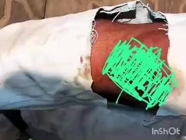 കുട്ടനാട്: പൈപ്പ് പൊട്ടിയ കുഴിയിൽ വീണ് സ്കൂട്ടർ യാത്രികന് പരിക്ക്