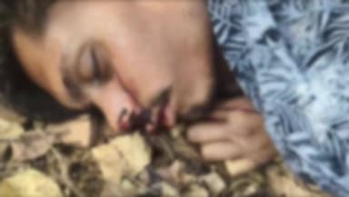 दमयंती नगर: सर्किट हाउस पहाड़ी पर युवक का शव मिलने से सनसनी, हत्या की आशंका, पुलिस जांच में जुटी