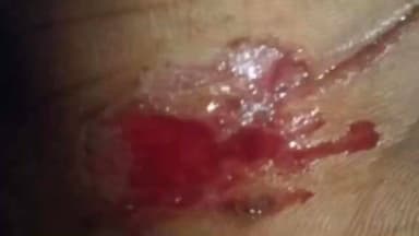 মগরাহাট ১: দেউলা মোড় এলাকায় বাইক এবং টোটোর মুখোমুখি সংঘর্ষে আহত হয় বাইক চালক