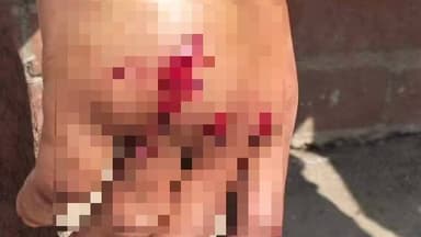 ডায়মন্ডহারবার ২: মানখণ্ড এলাকায় সাইকেল ও বাইকের সংঘর্ষে আহত সাইকেল আরোহী