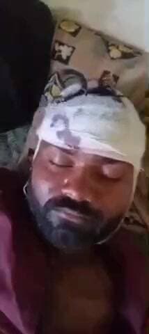 मारवाड़ जंक्शन: मारवाड़जंक्शन के जानुदा गांव में खेत में काम कर रहे युवक पर हमला, एक हमलावर गिरफ्तार, घायल को पाली रेफर किया गया