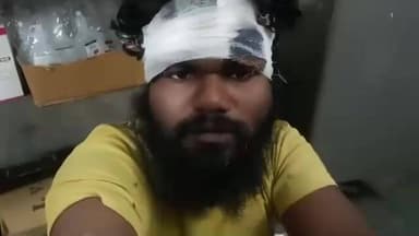 सतगावां: सतगावां थाना: भू विवाद में मारपीट से घायल वैधडीह निवासी लालू साव ने दी घटना की जानकारी