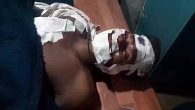 अंजड़: अंजड़ के राजपुर रोड पर कुत्ते से टकराकर बाइक सवार युवक घायल, अस्पताल से किया रेफर, एम्बुलेंस की मांग उठी