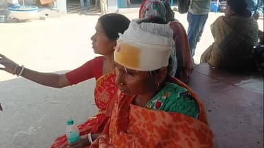 ভাতার: জায়গা সংক্রান্ত বিবাদের জেরে ভাতারের নারায়ণপুর গ্রামের এক মহিলার মাথা ফাটল, তিনি ভাতার থানায় দ্বারস্থ