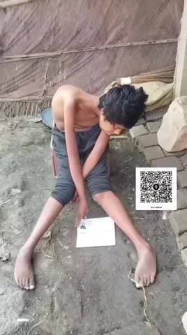 is bacche ko muscular distrophy bimari Hain kripya aap log jitna ho sake usko share kijiye aur iske liye jitna jyada Se