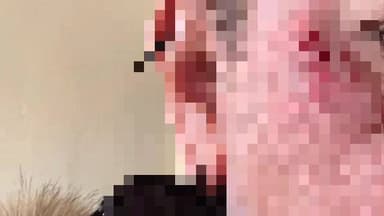 মন্দিরবাজার: লক্ষীকান্তপুর এলাকায় বাইক ও স্কুটির সংঘর্ষে আহত স্কুটি আরোহী