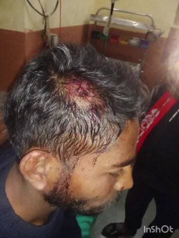 घाटोल: भमरियापाडा गांव में शादी समारोह में गए युवक पर जानलेवा हमला, लूट का आरोप लगाते हुए जिला पुलिस अधीक्षक को दिया ज्ञापन