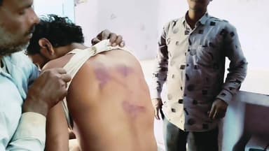 खेत में काम करने गए युवक के साथ मारपीट, पीठ पर गंभीर चोट के निशान
#मारपीट
#फसल_विवाद
#शाहनगर
#मलघन
#पीड़ित_किसान
#ग्रामी...