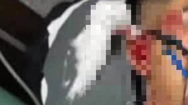 মন্দিরবাজার: মন্দিরবাজারের গাববেরিয়া এলাকায় একটি বাইক নিয়ন্ত্রণ হারিয়ে গাছে ধাক্কা মেরে আহত বাইক আরোহী