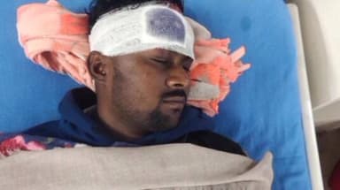 आदित्यपुर गम्हरिया: कोलाबिरा में दो बाइकों की टक्कर में दो युवक घायल