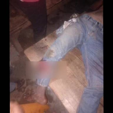 संझौली: काली मंदिर के पास ट्रक और बाइक के बीच टक्कर में दो लोग घायल