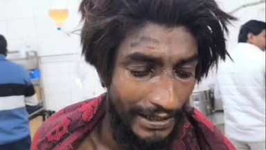 मछलीशहर: मजदूरी करके लौट रहे युवक पर चाकू से किया हमला, हालत गंभीर, वाराणसी रेफर