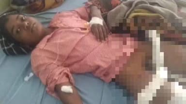 #जहानागंज की #मित्तुपुर के रहने वाले राजू गौड़ का पुत्र आदर्श को बस में मारी टक्कर दोनों पैर पर चढ़ गया पहिया, लड़खड़ाती...