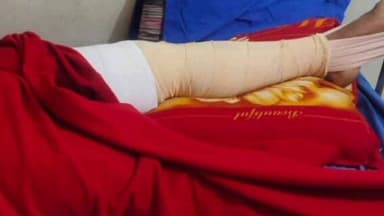 মন্দিরবাজার: দয়রামপুর এলাকায় দুটি বাইকের সংঘর্ষে আহত এক বাইক আরোহী