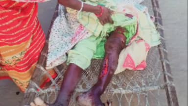 गुराबंदा: गुड़ाबांदा प्रखंड में जंगली हाथी के हमले में वृद्ध महिला गंभीर रूप से घायल