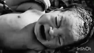 पीरो: पीरो अस्पताल में जन्मी बच्ची के पेट के बाहर दिखे आंत, देखने उमड़ी भीड़