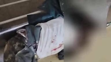 आंवला: आंवला-अलीगंज मार्ग पर अज्ञात वाहन ने बाइक सवार को टक्कर मारी, गंभीर घायल, जिला अस्पताल किया गया रेफर