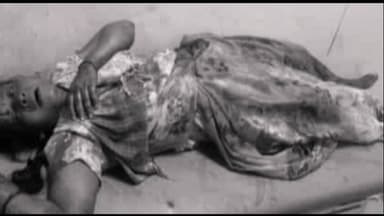 రామగుండం: పారిశ్రామిక ప్రాంతంలో కత్తిపోట్లు., ముగ్గురికి గాయాలు, ఒకరి పరిస్థితి విషమం