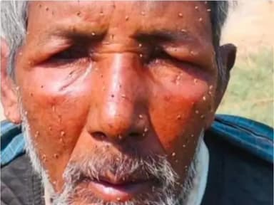 सफीपुर: मधुमक्खियों के झुंड ने बुजुर्ग पर किया हमला, सफीपुर के परियर-भादेवन मार्ग पर 65 वर्षीय व्यक्ति गंभीर घायल