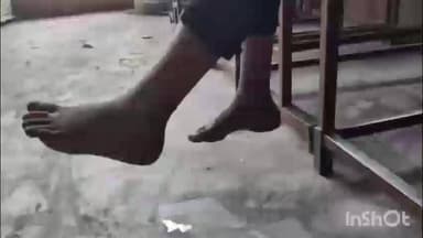 દાંતા: અંબાજીમાં રખડતા શ્વાનનો આતંક શ્વાને બાળકી ઉપર હુમલો કરતા સિવિલ હોસ્પિટલ ખસેડાઈ