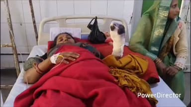 मऊ: रैपुरा के खजुरिहा खुर्द में कटिया मशीन में चारा काटते समय महिला के हाथ फंसने से उंगलियां कटीं