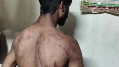 देवेंद्रनगर: देवेन्द्रनगर महावीरन के पास मामूली बात पर लाठी-डंडों से मारपीट