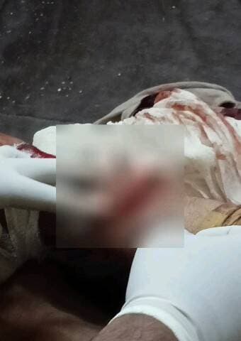 बीघापुर: गिरजानगर में लंगूर का आतंक, बारात में लड़की को किया घायल