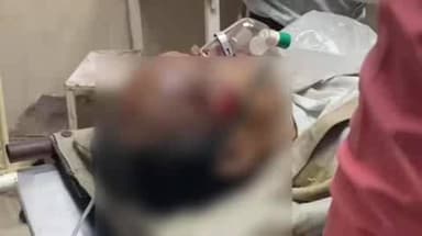 फर्रुखाबाद: ग्राम पुठरी के पास ट्रैक्टर की टक्कर से बाइक सवार झोलाछाप डॉक्टर गंभीर रूप से घायल, जिला अस्पताल से कानपुर किया गया रेफर