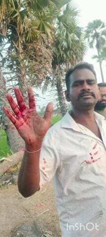 నాలుగో డివిజన్ కార్పొరేటర్ బొంగు అశోక్ యాదవ్ స్థానిక కార్యకర్తపై కత్తిపోట్లు