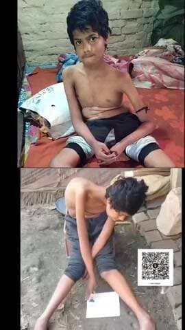 is bacha ko maskular distorofi bimari hai please is bache ke ilaz ke liye madad kijiye aur share kardijiye
Sitamadhi