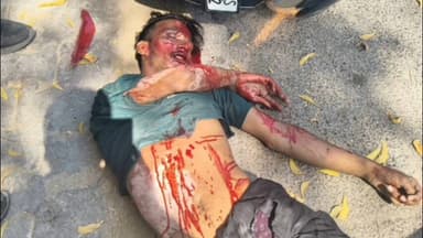 आबू रोड: आबूरोड के विष्णु टॉकीज के पास सीमेंट से भरे डंपर की चपेट में आने से एक्टिवा सवार की हुई मौत, मौके पर पहुंची शहर पुलिस