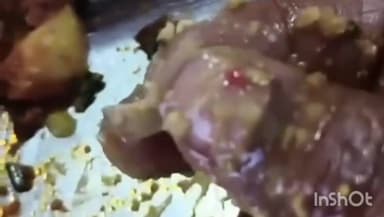 उज्जैन शहर: होटल साईं दरबार के खाने में नाखून निकलने पर खाद्य विभाग ने लिए सैंपल, वीडियो वायरल