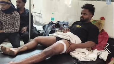 मंडला: मंडला बस स्टैंड में बीती रात चाकूबाजी, युवक गंभीर घायल; SDOP पीयूष मिश्रा ने दी जानकारी