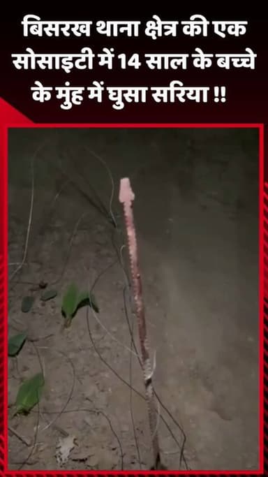 दादरी: बिसरख थाना क्षेत्र की एक सोसाइटी में 14 साल के बच्चे के मुंह में घुसा सरिया