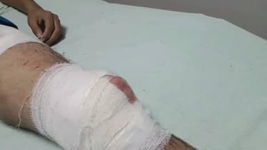 लाडपुरा: कोटा में युवक पर घर के बाहर चाकू से हमला, 3 बदमाशों ने 4-5 वार कर किया गंभीर घायल, MBS अस्पताल में उपचार जारी