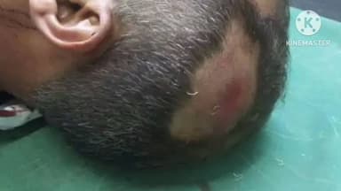 અમદાવાદ શહેર: કાગડાપીઠ પોલીસ સ્ટેશન વિસ્તારમાં પોલીસ કોન્સ્ટેબલ ઉપર બુટલેગરે હુમલો કર્યો