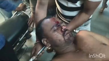 कोल: इंद्रा नगर में पुरानी कहासुनी को लेकर आधा दर्जन दबंगों ने दो भाइयों को जमकर पीटा, एक को ईंट मारकर किया लहूलुहान