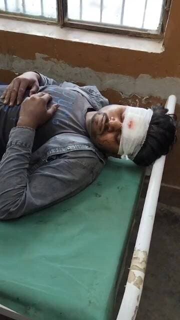 हसनगंज: उन्नाव के मुंशीगंज अजगैन मार्ग पर नरायणपुर गांव के पास दो बाइकों की आमने-सामने टक्कर, एक व्यक्ति की मौत, दो घायल