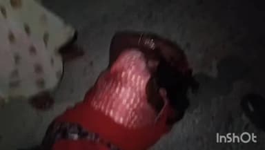 उरई: ग्राम कुकरगांव में विवाद के चलते दबंगों ने महिला के सिर पर कुल्हाड़ी मारी, पुलिस पर मूकदर्शक रहने का आरोप