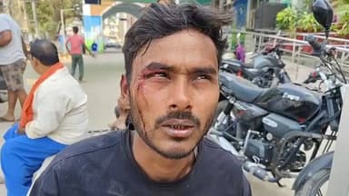 आरा: आरा में होली के दिन मिट खरीदने को लेकर हुए विवाद में दुकानदार समेत 2 लोगों की पिटाई