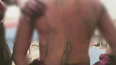 लोहरदगा शहरी क्षेत्र में होली की खुशियों के बीच युवक पर जानलेवा हमला, बाल-बाल बची जान